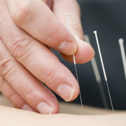 Acupuncture Reduce Cravings