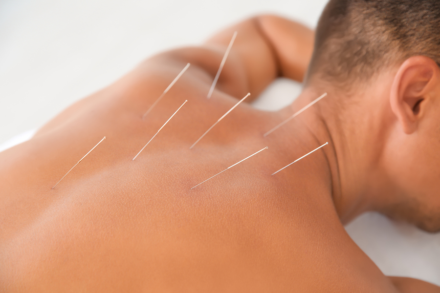 A man undergoing acupuncture for addiction during rehab.